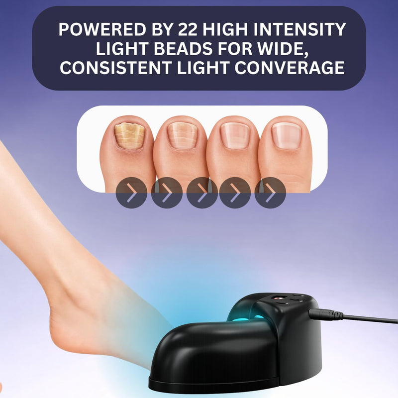 Nail Fungus Blue Light Therapy Device for Toenails & Fingernails, Home Use Toenail Fungus Treatment Device for Onychomycosis