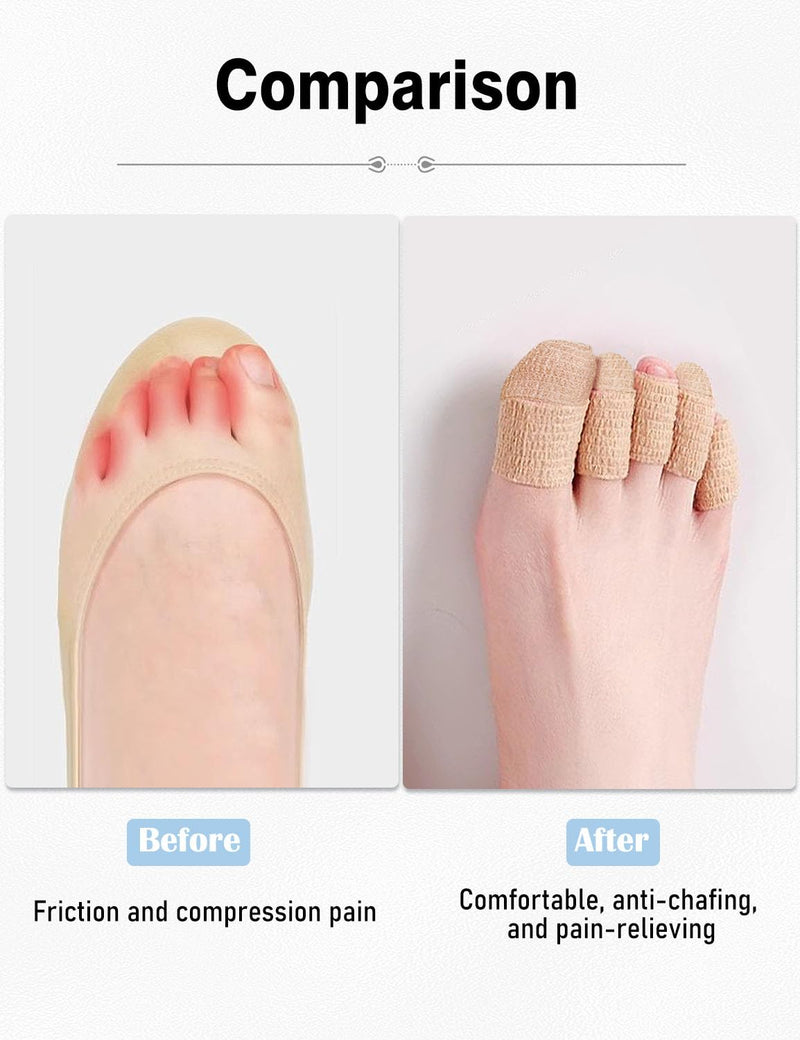 Fizzest Broken Big Toe Little Toenail Protectors Women Men，Toe Caps Covers Bandage，Toe Cushions for Pain Relief，Ingrown Toenail Treatment，Corn Removers for Toes (Khaki, Large Size(16 Rolls 1 Box)) Large size(16 rolls 1 box) Khaki - BeesActive Australia