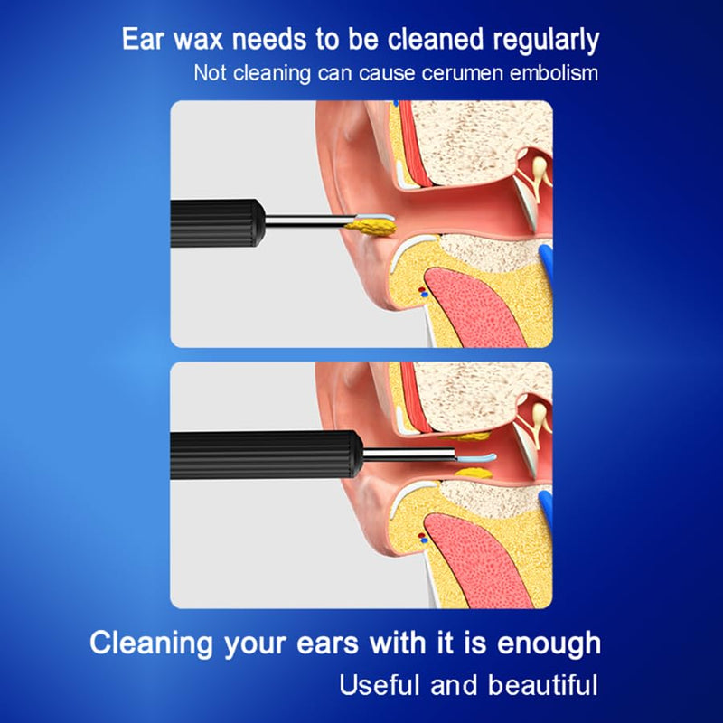 Ear Wax Removal,Earwax Remover Tool with Camera,Ear Cleaner with 6 LED Lights Otoscope for iOS & Android,Earwax Removal Kit with 7 Pcs Ear Pick(Including 5 Ear Spoon) - BeesActive Australia