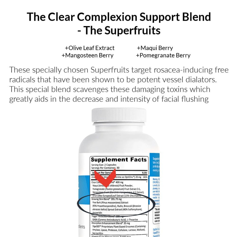 Rosacea Skin Care Supplement for Redness of Face, Eye and Nose | Targets the Root Cause of Symptoms