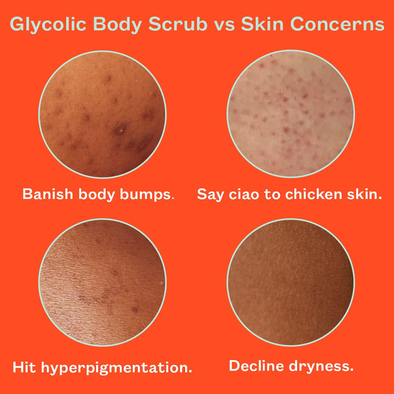 Frank Body Glycolic Body Scrub | Vegan, Cruelty Free, Exfoliating Body Scrub | Helps to Fight Breakouts and Soothes Skin & Marks with AHA, Pumice, Witch Hazel, and Niacinamide | 8.82 oz / 250 g - BeesActive Australia