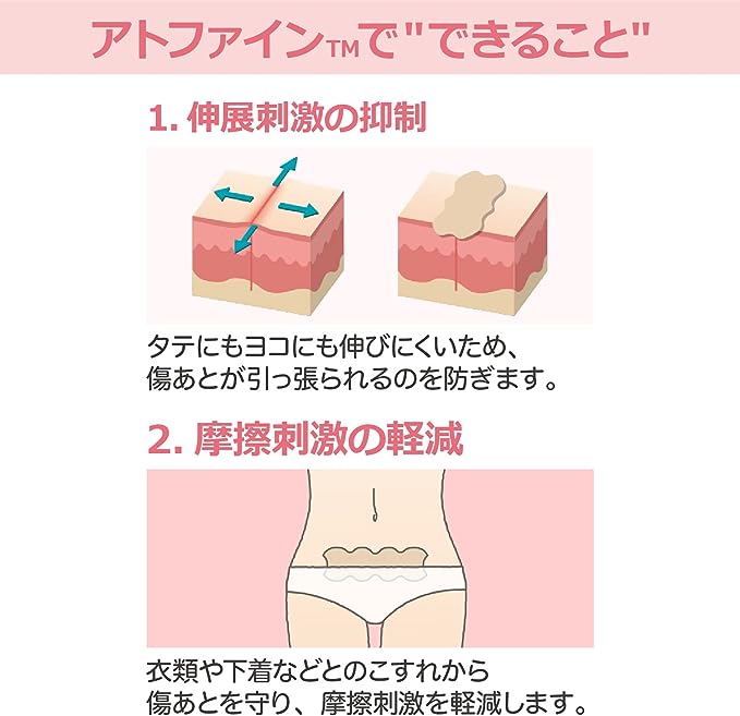Atwine Small Size 12 My Scar Care Tape, Post-Surgical Scar Care (Compatible Scar Size: 0.4 - 1.6 inches (1 - 4 cm)) -  Australia