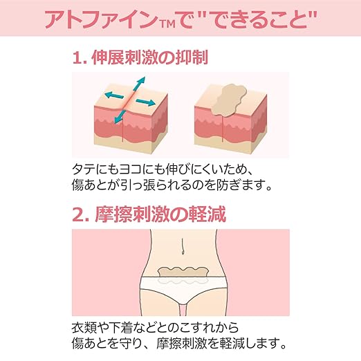 Atwine LL Size 4 My Scar Care Tape, Post-Surgical Scar Care (Compatible Scar Size: 5.9 - 7.9 inches (15 - 20 cm)) -  Australia