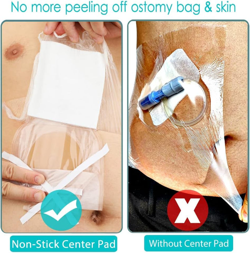Waterproof Ostomy Bag Shower Cover with Non Sticky Pad Colostomy Ilostomy Urlostomy Pouch Shower Guard Shield Ostomy Cover(10.2"x10.2", Pack of 25) - BeesActive Australia