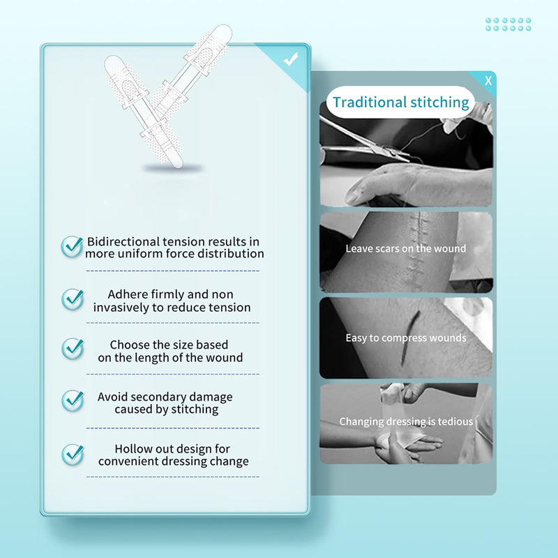 Wound Closure Strips Zip Stitch Sutures Butterfly Bandaids Emergency Laceration Closure Kit for Lacerations Incisions Cuts(6X8CM) 6x8cm