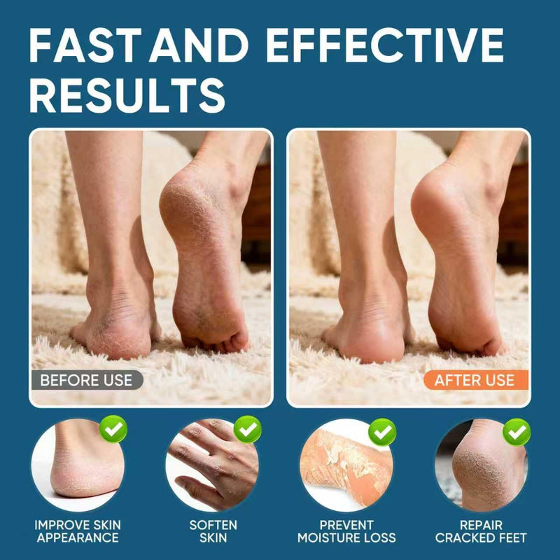 Urea Cream 60% Plus Salicylic Acid 2%, Urea Cream 60 Percent for Feet Maximum Strength, Foot Cream for Dry Heels Cracked
