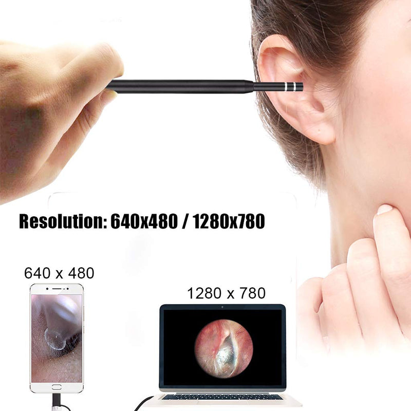 Ear Wax Removal - 3 in1 USB Earwax Removal Tool HD Ear Cleaner Endoscope with 6 LED Light, Earwax Remover Tool, Visual Ear Camera Ear Pick Cleaning Kit for Adults Kids Pets by Android Smart Phones - BeesActive Australia