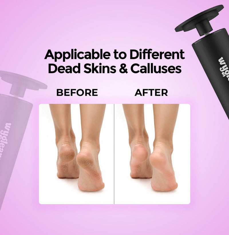 Electric Callus Remover for Feet & Nail File Drill Kit - 2 in 1 Rechargeable Pedicure Tools for Flawless Feet - Professional Foot File with 3 Speeds for Dead Skin Removal - At Home Pedicure Black - BeesActive Australia