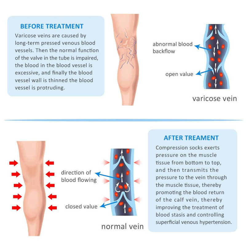 20-30mmHg Compression Pantyhose for Women, Medical Compression Stockings, High Waist Opaque Compression Tights for Lymphadema Edema, Swelling, Varicose Veins, Support Hose for Teacher Doctor M Beige