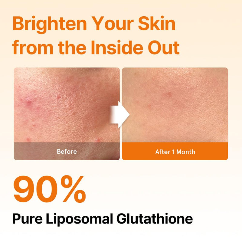 ESTHER FORMULA Liposomal Glutathione Strips (30 ct) - Glutathione Direct | Liposomal Glutathione Supplement with 90% Pure L-Glutathione for Antioxidant & Skin Glow Support, Fast-Absorbing Oral Strips 1