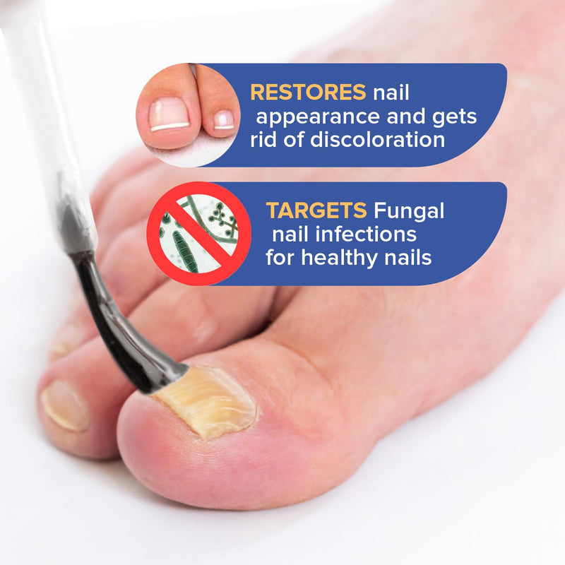 Toenail Fungus Treatment Extra Strength - Nail Fungus Treatment for Toenail - Toe Nail Fungus Treatment Extra Strength - Nail Fungus Treatment, 1 fl oz
