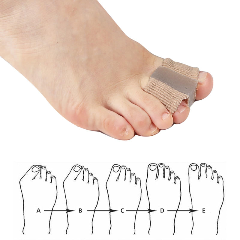 Toe Separator for Bunions Corrector Hammer Toes Big Toe Stretcher and Straightener Comfortable Soft Fiber 2 Pairs S+L