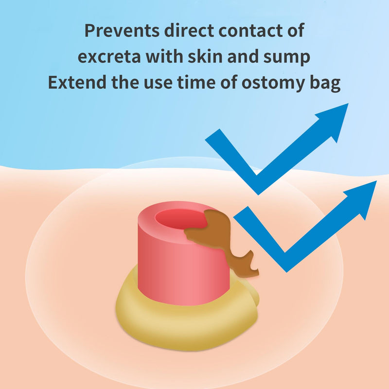 Stoma Skin Barrier Ostomy Paste - Protective Ostomy Skin Barrier Supplies - Stoma Adhesive Skin Protectant Paste - Ostomy Skin Barrier Paste, 2 oz - BeesActive Australia