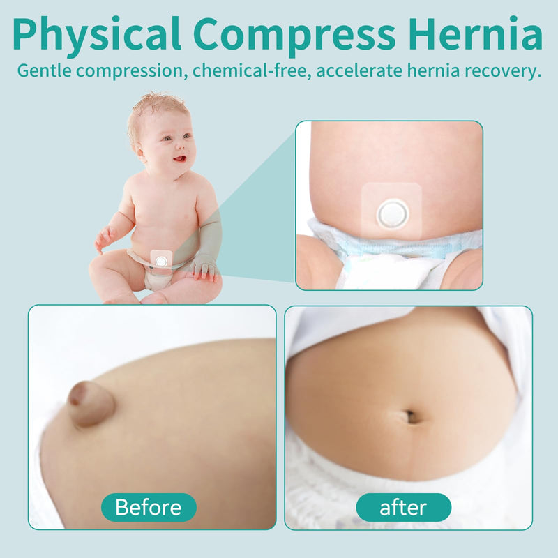 Baby Belly Navel Patches, Belly Button Shaper with Cotton Pads, Waterproof Umbilical Patch, Infant Essentials Must Haves (14PCS 10 * 10CM) 14PCS
