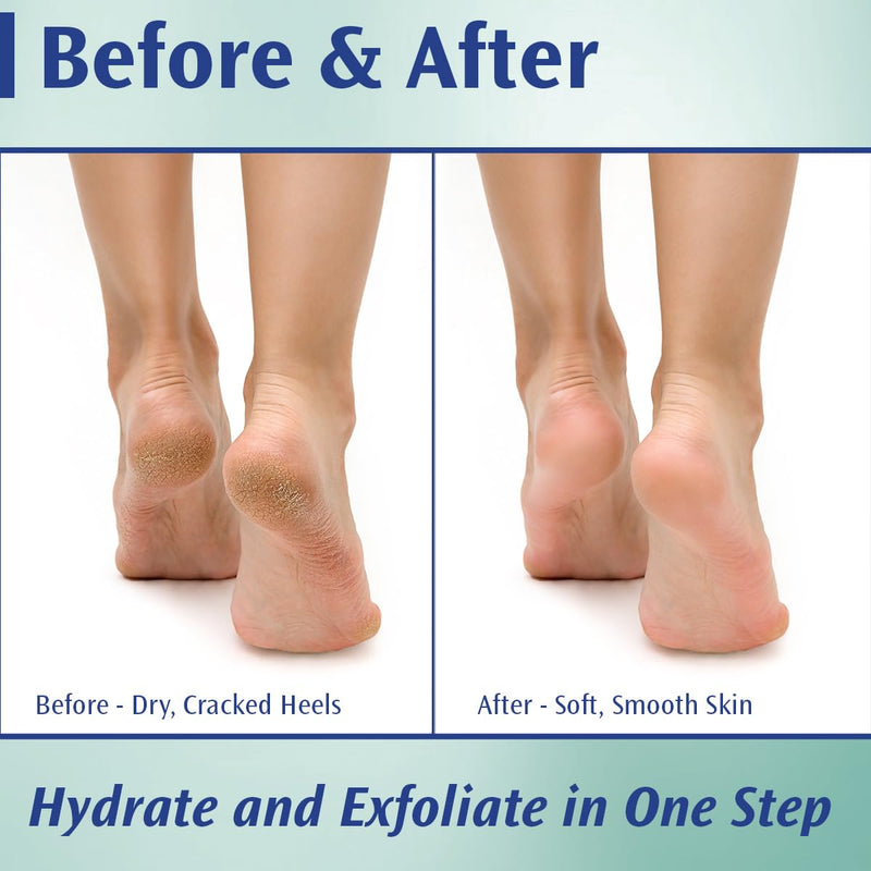 Pedifix Podiatrists' Choice 20% Urea Callus Control Extra Strength Foot Cream 4 Oz. (113g) - Professional Treatment for Dry, Cracked Feet, Callus & Foot Care Relief - BeesActive Australia