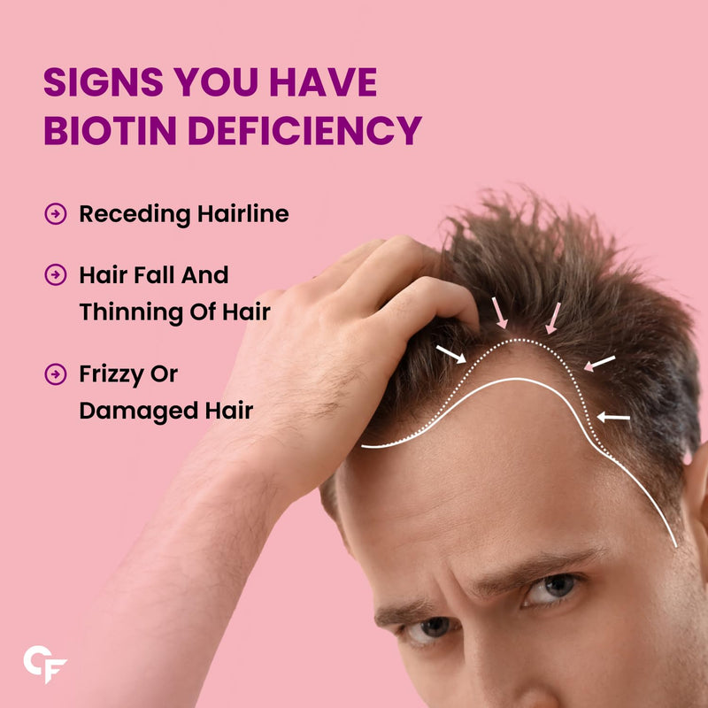 Carbamide Forte Biotin 10000mcg (High Potency) per Veg Tablet - Supports Hair Growth, Glowing Skin and Strong Nails - Biotinova (120 Tablets)