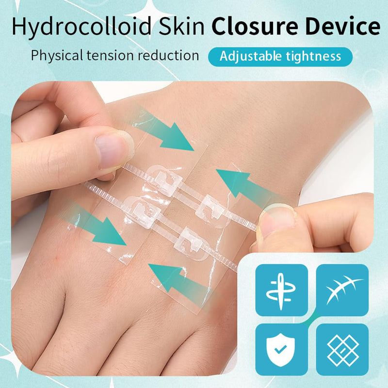 Wound Closure Strips 50x70mm Hydrocolloid Laceration Closure Zip Stitch Adjustable Skin Closures for Home First Aid Kit 2 Pack