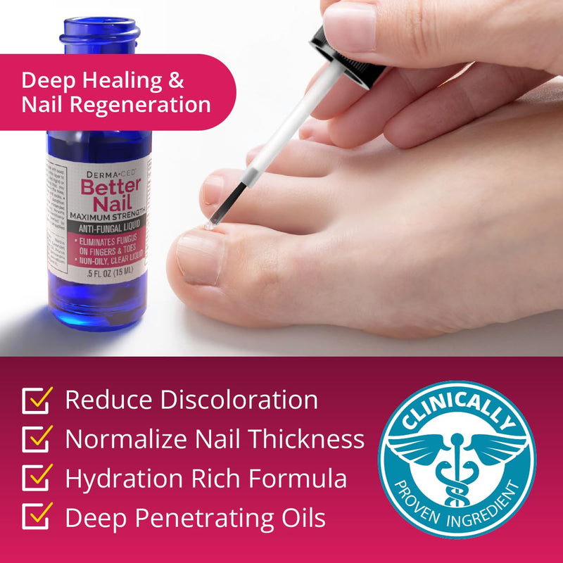 Better Nail - Rejuvica - Extra Strength Nail Fungus Treatment - 25% Undecylenic Acid Maximum Strength Antifungal Solution helps Discolored & Damaged Nails - Supports Healthy Nails with 6 Natural Oils 0.5 Fl Oz (Pack of 1)