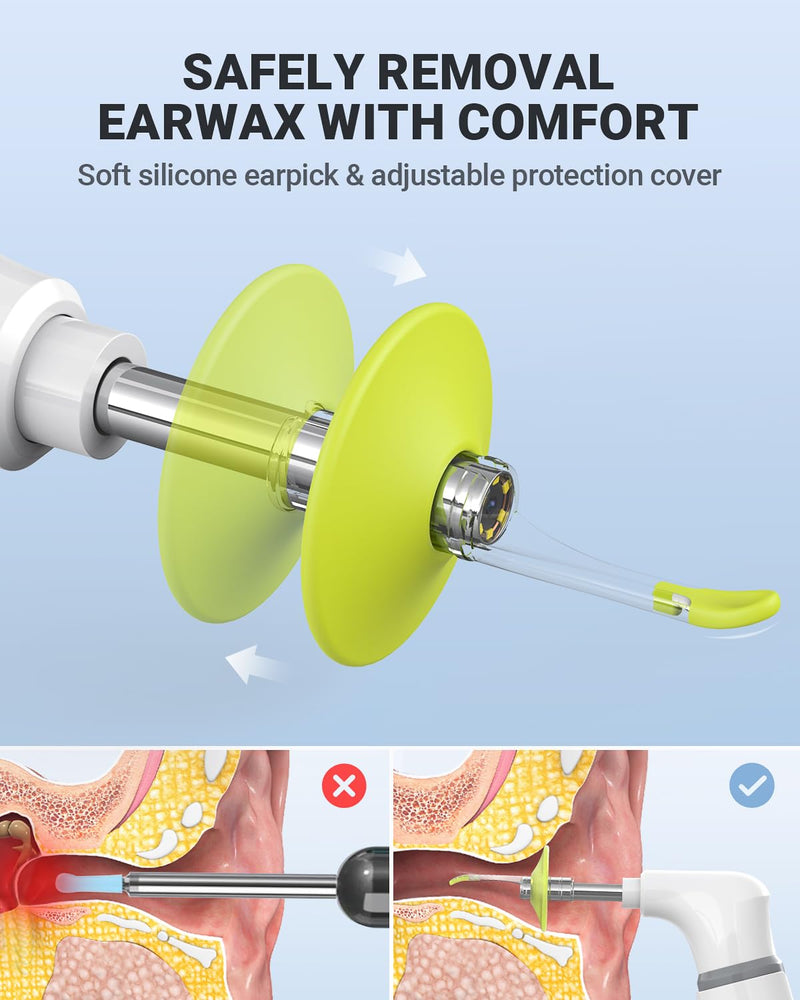 Wireless Otoscope with Gyroscope, Ear Camera with Dual View, 3.9 mm Otoscope with Light, Ear Scope with Ear Wax Removal Tool for Kids, Adults, and Pets, Compatible with iPhone and Android - BeesActive Australia