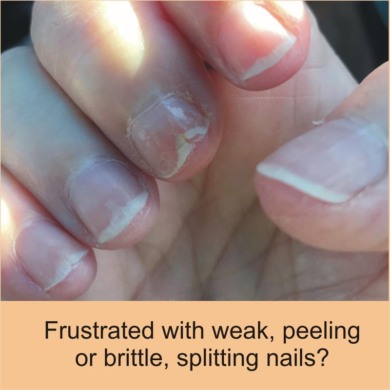 FlexiNail Penetrating Fingernail Conditioner and Strengthener. Conditioning Treatment for Peeling, Weak, Brittle & Splitting Nails | Natural Nail Repair & Growth 1 Count (Pack of 1) - BeesActive Australia
