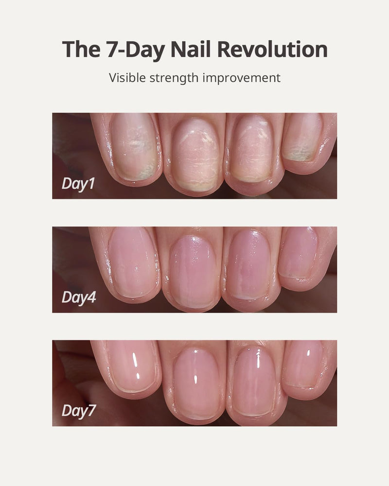 BTARTBOXNAILS Naillush Nail Strengthener & Growth - Repair Damaged Nails, Strengthen Weak & Thin Nails, Extra Strong Nail Growth Treatment, Long Lasting Nail Hardener, 15ml C-Naillush Nail Strengthener & Growth 15ml - BeesActive Australia