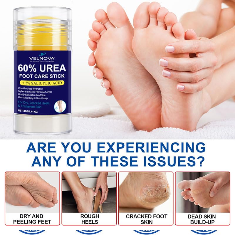 60% Urea Foot Care Stick with 2% Salicylic Acid – Maximum Strength Callus Remover & Foot Cream for Dry Cracked Heels – Exfoliating Moisturizer, Non-Greasy – 1.41 oz