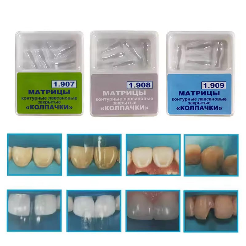 Dental Clear Matrix Anterior Matrice, BT Anterior Matrices Bioclear Style, Transparent Bow Anterior Matrices Sectional Contoured Matrix System (1, S) 1