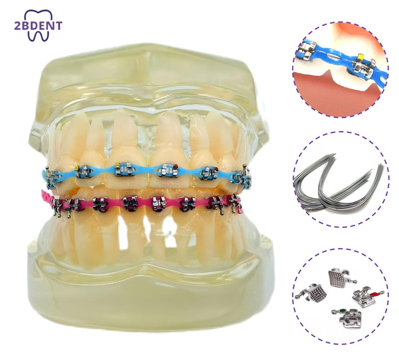 Decorative Braces-Style Kit