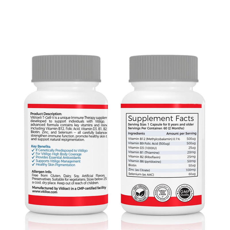 Vitilox Vitiligo T-Cell-V Immune Therapy Capsules – 4 Months Supply