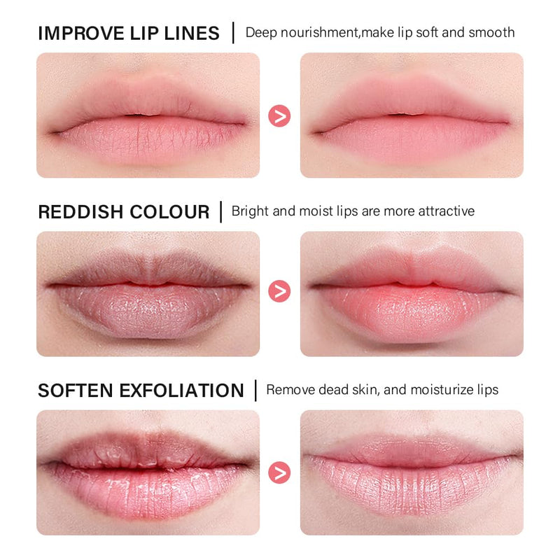 Clouds Bee Propolis Vanilla Lip Balm ‚Äì Hydrating & Moisturizing Overnight Lip Sleeping Mask, Exfoliating Lip Treatment with Bee Extracts, Natural Care for Dry Lips, Honey Pot Design