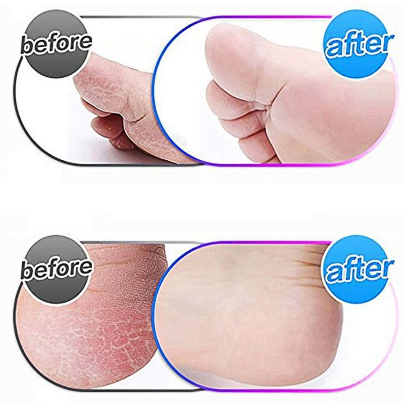 8 Pack Black Replacement Roller Refills Compatible with Scholl Express Pedi Foot Smoother-Extra Coarse 8 Pack Black - BeesActive Australia