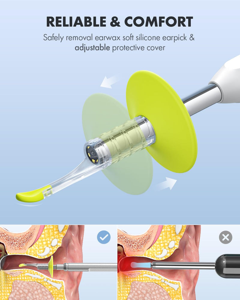 Ear Wax Removal Tool, Replacement Ear Spoon Tips Ear Cleaner, Ear Pick for Anykit Otoscope, Ear Wax Remover Pack of 3. (Green w/ 2 Size) - BeesActive Australia