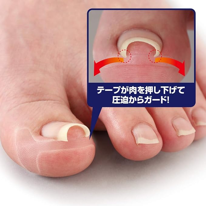 Cyprus Transparent Wrap Nail Tape, Thin Transparent Plate, Double Layered Construction, Transparent Tape, Not Conspicuous, Miene -  Australia