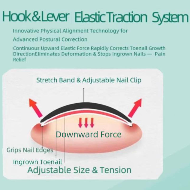 Ingrown Toenail Corrector Kit for Men Women - Ingrown Nail Tool - 2 Stainless Steel Clips- Curved Nail Strips & Toe Pads for Embedded/Curled Nails