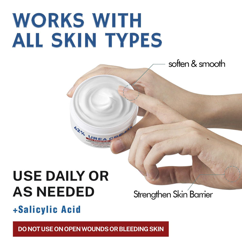 OUKEYA Urea Cream 42% plus Salicylic Acid 2% for Dry Cracked Feet, Heel, Knees, Elbows, Hands – Intensive Moisturizing Cream for Very Rough Skin, 5.29 oz, Pack of 2 5.29 Ounce (Pack of 2)