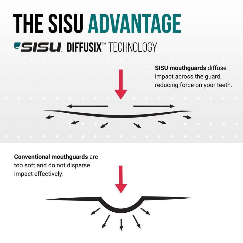 SISU Aero Medium Mouthguard, Lucky Lavender - 30% Stronger Protection for Lacrosse, Football, Hockey, Roller Derby, Team Sports - Remoldable Up to 20 Times - Ultra Slim - Works for Braces - Non Toxic Medium (5' - 6' tall) - BeesActive Australia