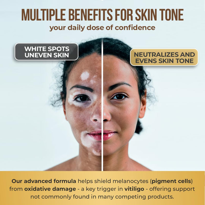 Dermawonder Vitiligo Capsules (60 Count) Effective Vitiligo Supplement, Reduce White Spots & Improve Skin Pigmentation Support, for All Skin & Reduce White Spots on Skin and Tinted Skin 1