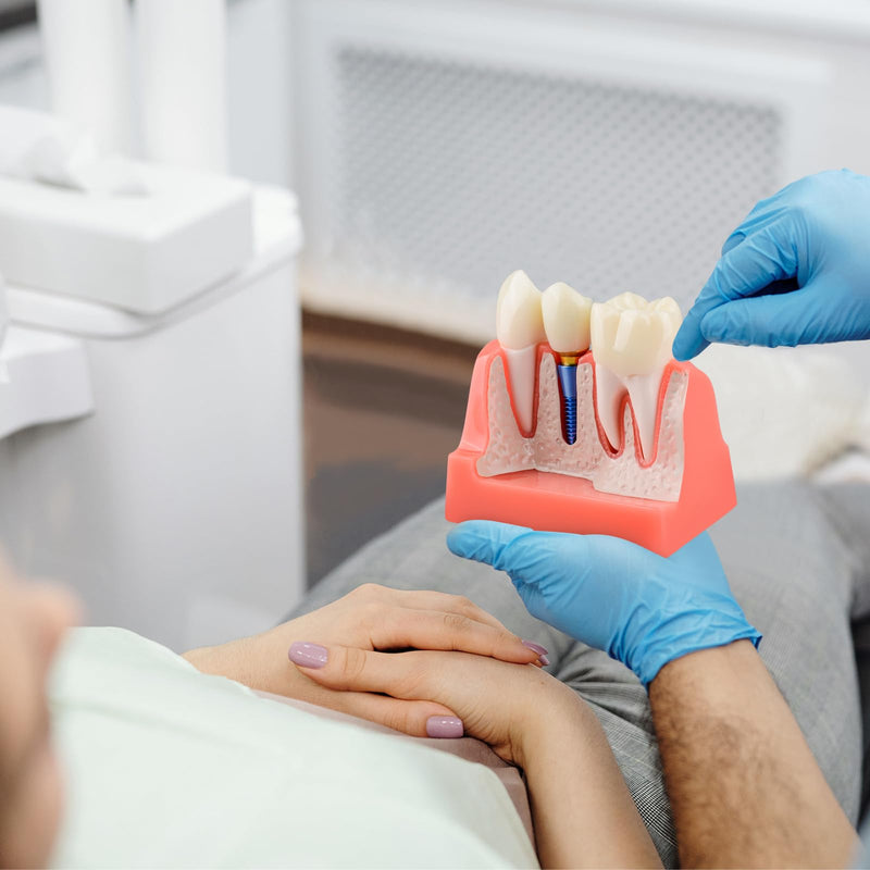 Ultrassist 4 Times Dental Implant Model for Patient Education Pink