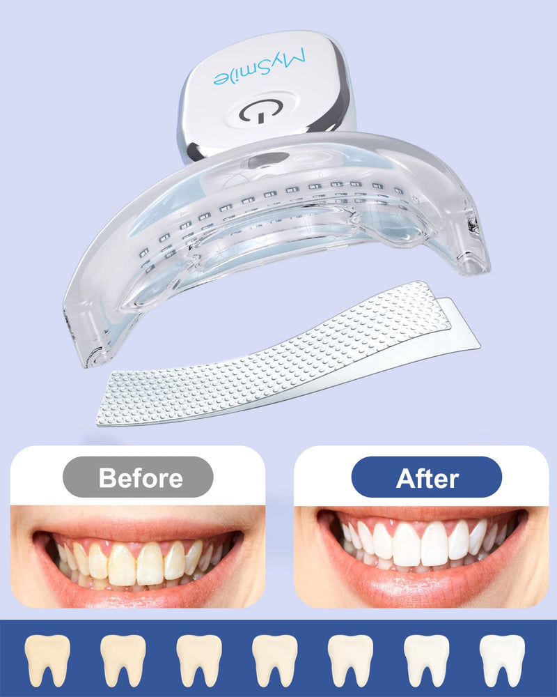 MySmile Teeth Whitening Kit with led Light, 28X Teeth Whitening Strips for Teeth Sensitive, 10 Min Fast Whitening , Helps to Remove Stains from Coffee, Smoking, Wines(1Pcs Light + 14Sets Strips) 1 Count (Pack of 1) - BeesActive Australia