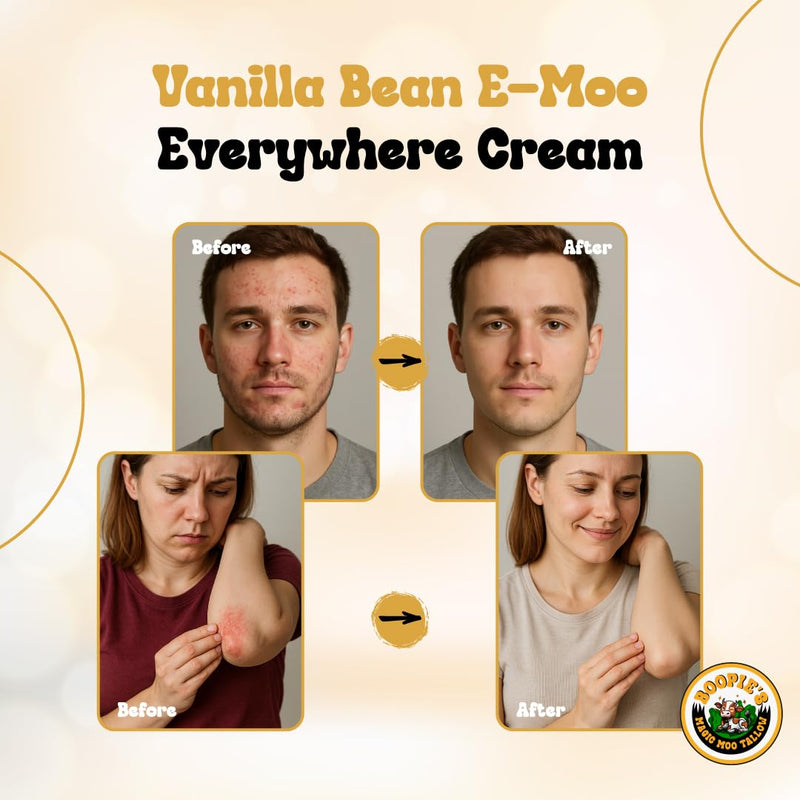 Magic Moo Beef Tallow Vanilla Bean E-Moo Moisturizing Everywhere Suet Tallow Cream with Organic Emu Oil. For Acne, Stretch Marks, Eczema, Hydration, Dry Skin & More! 2oz 2 Ounce (Pack of 1) - BeesActive Australia