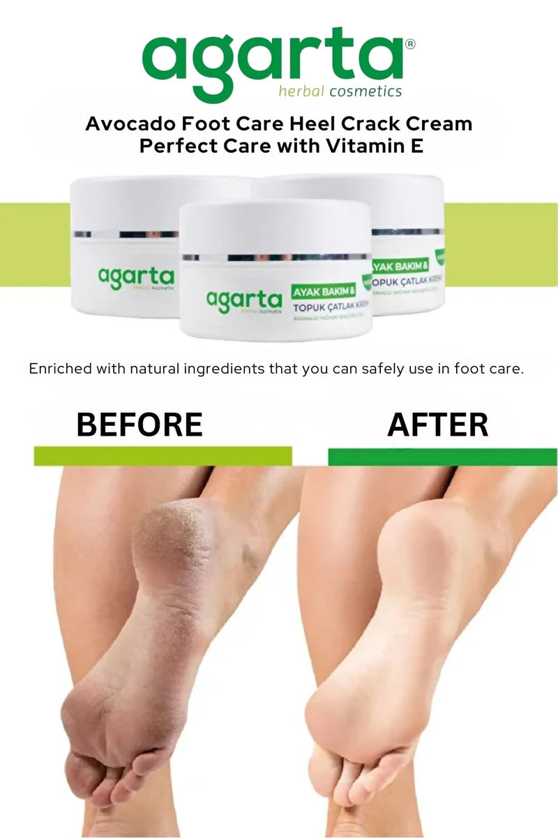 Agarta Foot & Heel Care Cream – Hydrating & Smoothing Moisturizer for Soft, Comfortable-Looking Feet, Daily Botanical Care, Vegan Formula – 3.38 fl oz - BeesActive Australia