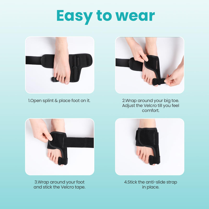 Promifun Toe Splint for Broken Toes - Big Toe Splint for Women & Men - Support Brace for Day & Night Use - Bunion Corrector - 1 Pair - BeesActive Australia