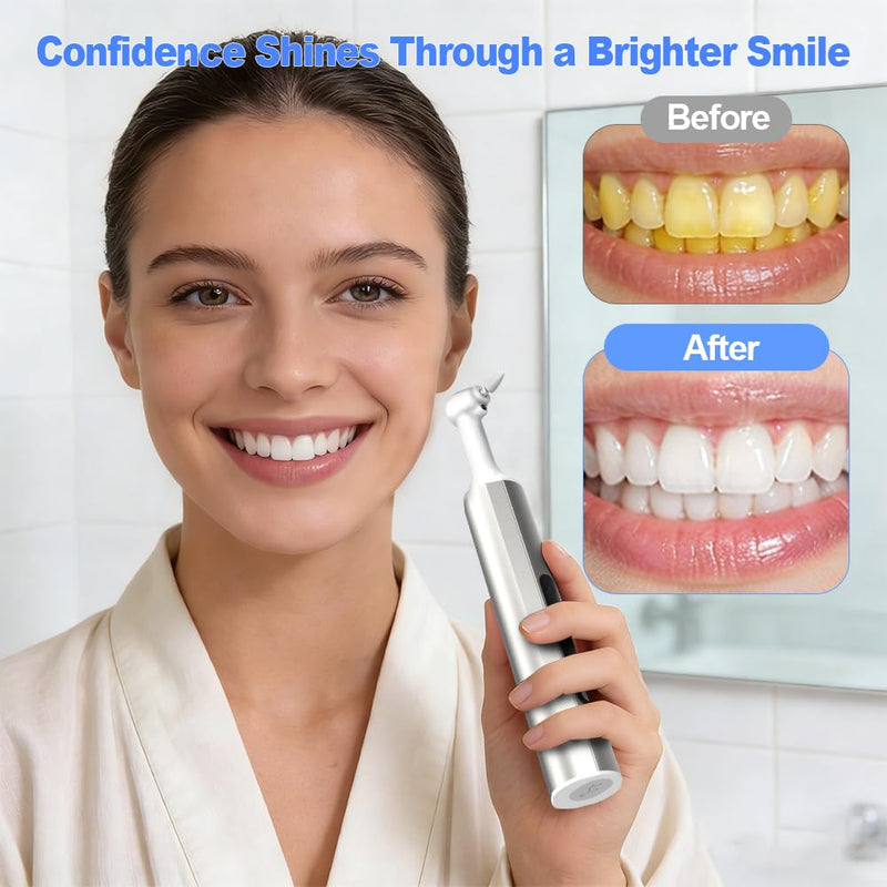 Home Tooth Polisher,Multi-Functional LED Tooth Polisher,Aluminum Alloy with Anti-Slip Texture,9 polishing Paste Units,USB Type-C Charging,6 Polished Accessories,Personal Portable Dental Care Tool - BeesActive Australia
