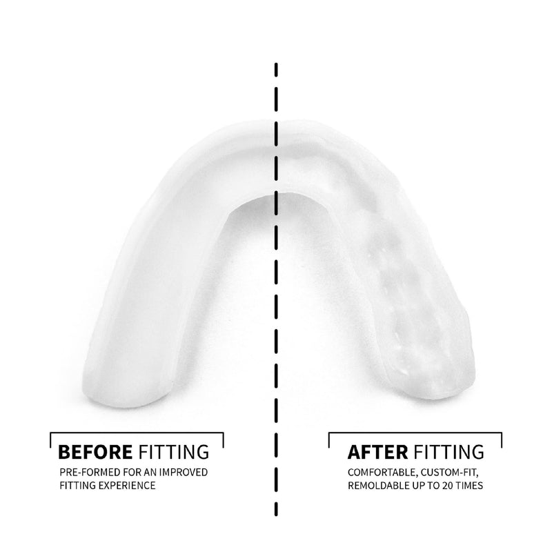 SOVA 3D Night Guard - 2.0mm Thin - Custom-Molded Fit - Protects Against Nighttime Teeth Grinding & Clenching - FSA/HSA Eligible - Odor & Taste Free - Remoldable Up to 20 Times - Non Toxic - BeesActive Australia