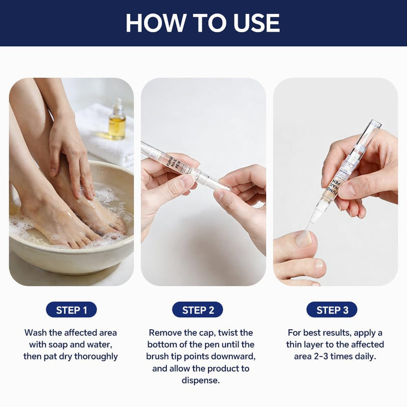 Toenail Fungus Pen - with 25% Undecylenic Acid - Effective Nail Repair for Damaged Nails, Ingrown Nails & Discoloration - 4-Pack Twist Pen