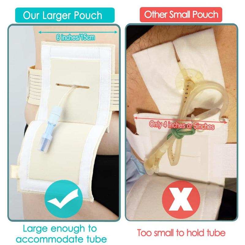 [2 Pack] Feeding Tube Belt, PEG Tube Holder G-Tube Protective Belt Breathable Beige with Slit for G Tube J Tube PEG Tube Supplies, No More Taping The Tube Medium (Pack of 2)