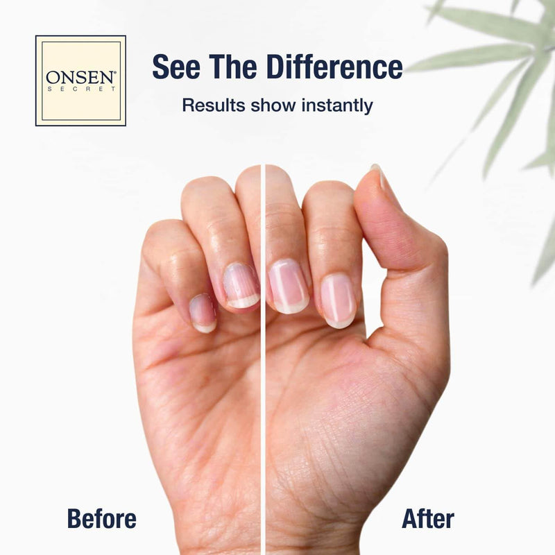 Onsen Secret Nail Care Kit - w/Cuticle Care Serum, Japanese Nail Buffer and Shine Kit - Strengthening & Shining - Spa-Quality Manicure - Organic Ingredients - Long-Lasting Shine - Easy & Safe - 1pk Essential Nail Reboot Kit (Serum)