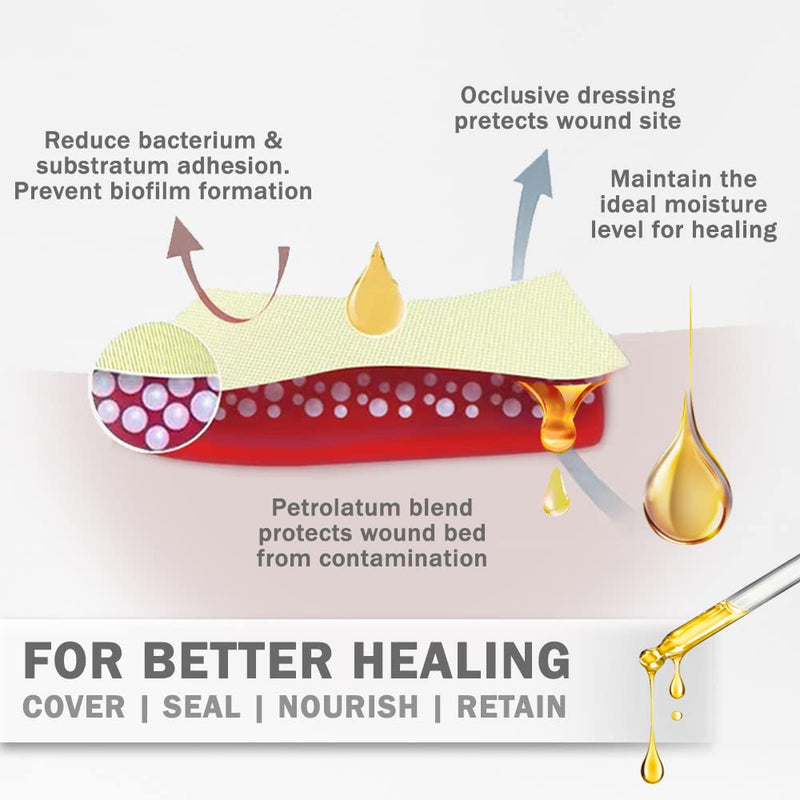 EVERLIT Xeroform Petrolatum Dressing | Sterile, Non-Adherent Occlusive Fine Mesh Gauze Pad | Non-Toxic, Gentle Patch for Burns, Laceration, Surgical Incisions & Skin Grafts (1" x 8" | Pack of 50) 1" x 8" | Pack of 50