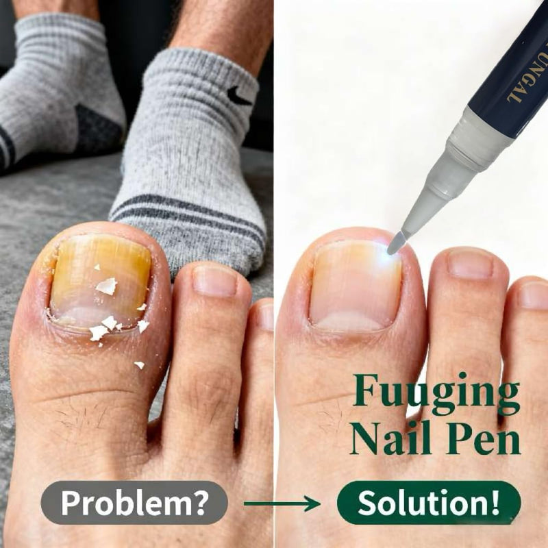 Toenail Fungi Treatment Extra Strength & Fungi Nail Pen - 4PC Fungi Nail Pen Repair for Damaged Nails,Targeted Solution for Nail Health Concerns (Athletes Ideal), 4ml/0.14FLOZ -2 Blue-3 - BeesActive Australia