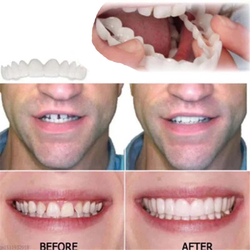 Fake Teeth Denture Teeth Temporary Snap On Veneers Cover The Imperfect Teeth Fix Confident Smile - BeesActive Australia